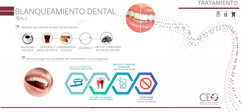 Tratamiento