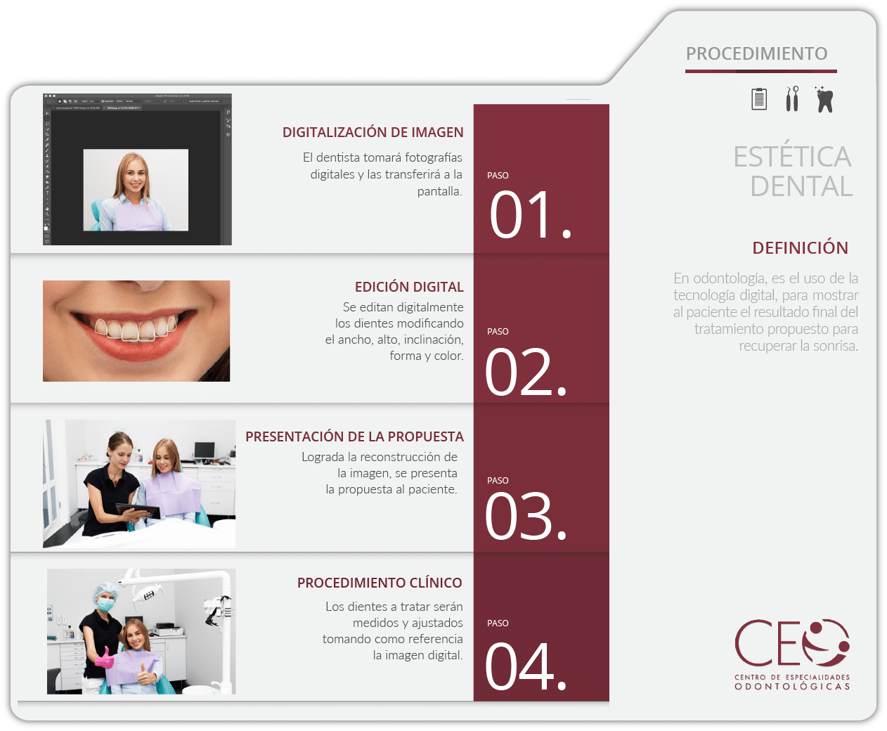Procedimiento