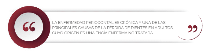 La enfermedad periodontal es crónica y una de las principales causas de la pérdida de dientes en adultos, cuyo origen es una encía enferma no tratada.